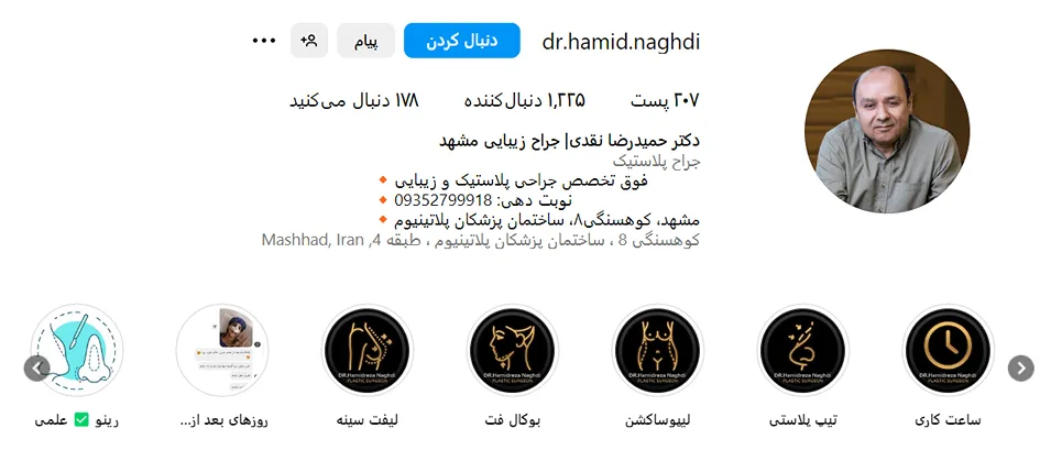 دکتر نقدی از بهترین جراح لیفت سینه در مشهد است