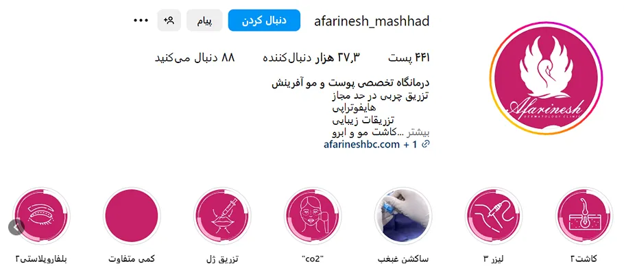 کاشت مو اقساطی مشهد در کلینیک آفرینش قابل انجام است