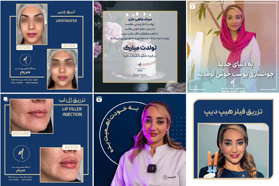 تزریق چربی در مشهد در کلینیک پوست و مو مریم کاملا قابل انجام است