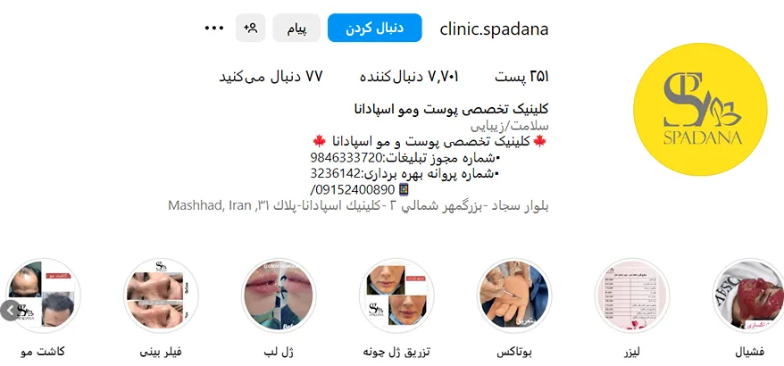 مرکز زیبایی اسپادنا از بهترین مرکز اندولیفت در مشهد است