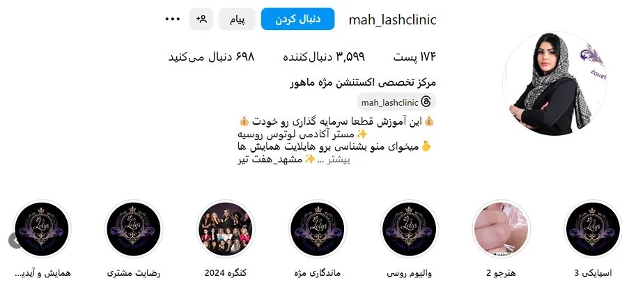 کاشت مژه در مشهد توسط مرکز ماهور قابل انجام است