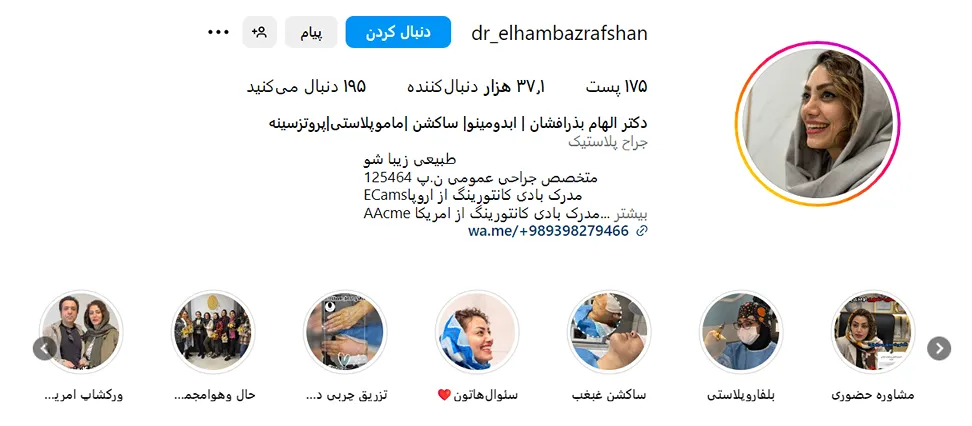 دکتر بذرافشان از بهترین دکتر ماموپلاستی در مشهد است