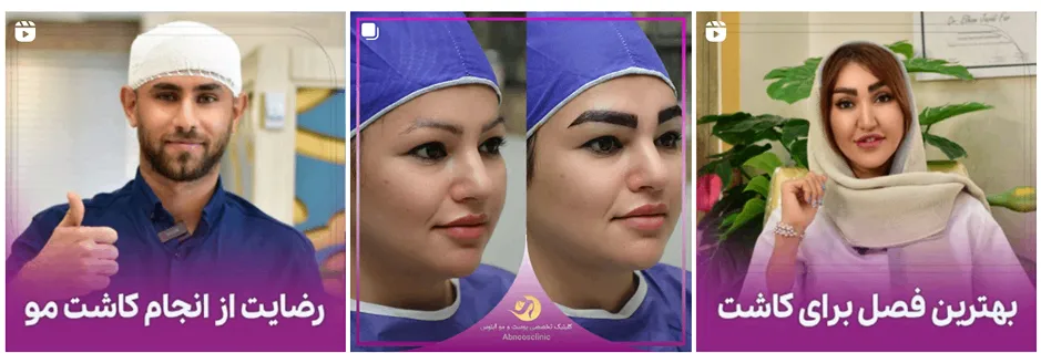 مرکز زیبایی آبنوس یکی از بهترین کلینیک زیبایی در مشهد است