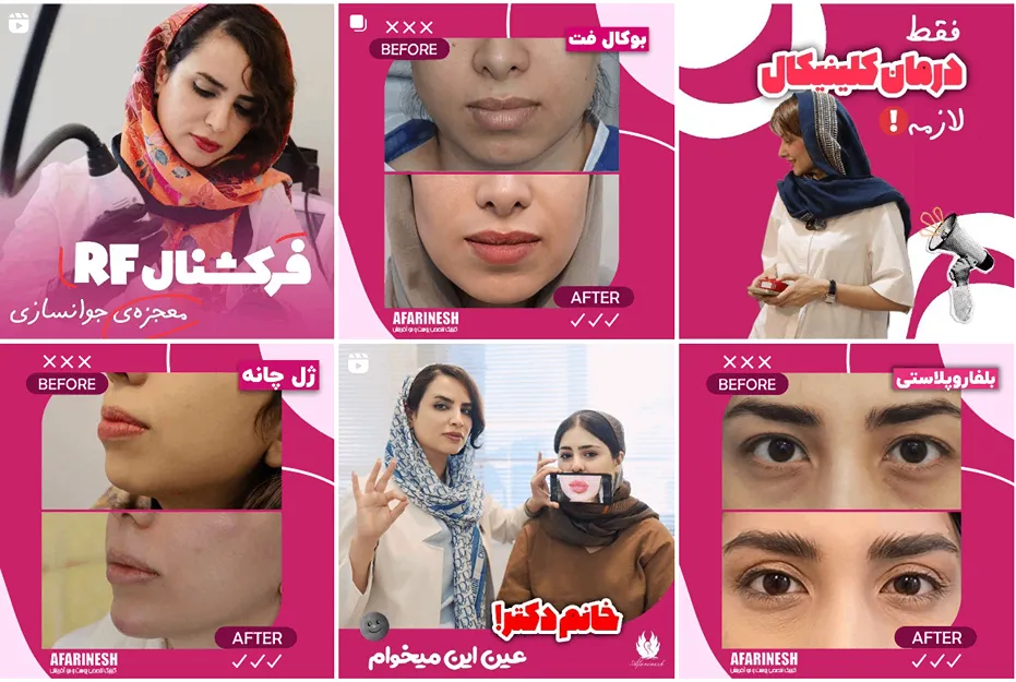 کلینیک آفرینش از بهرتین کلینیک تزریق فیلر در مشهد است