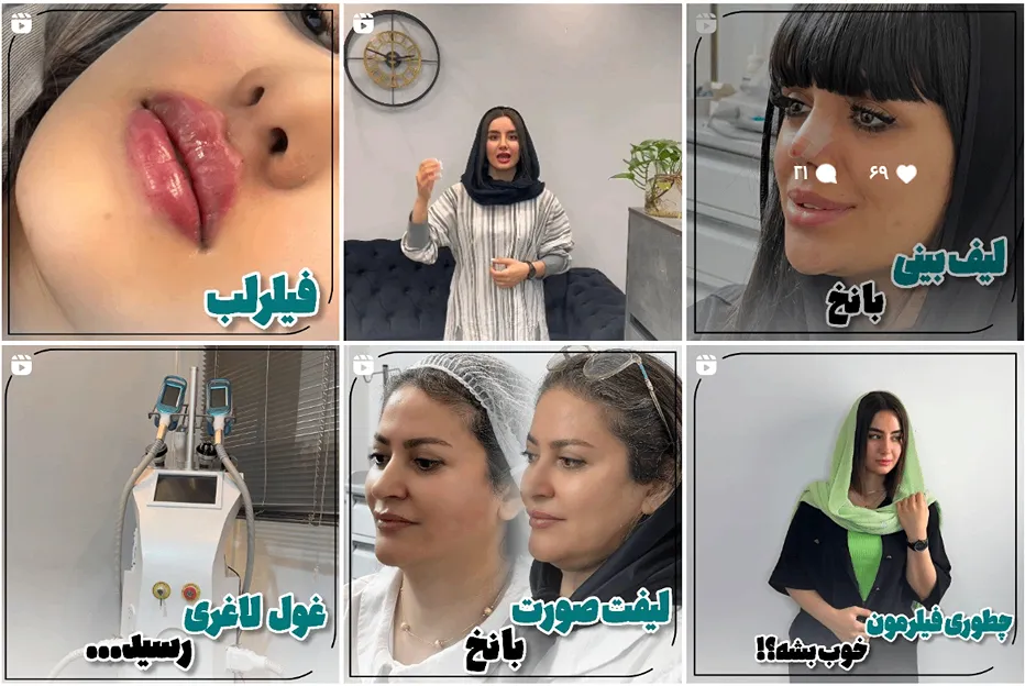 تزریق فیلر در مشهد توسط کلینیک الین کاملا قابل انجام است