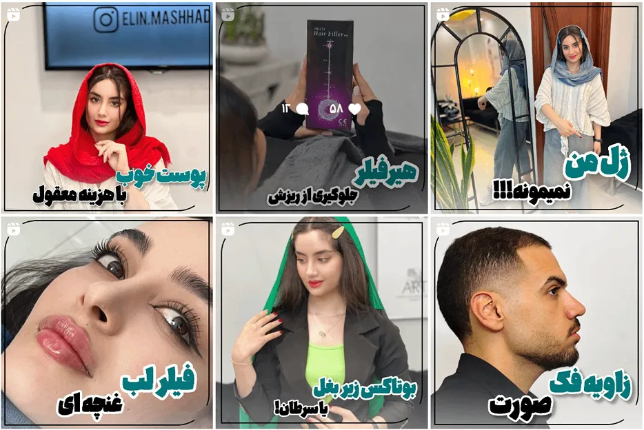 تصویر یکی از بهترین کلینیک ژل لب روسی در مشهد را مشاهده میفرمایید.