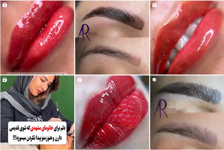 شیدینگ لب در مشهد توسط رویا امینی کاملا قابل انجام است