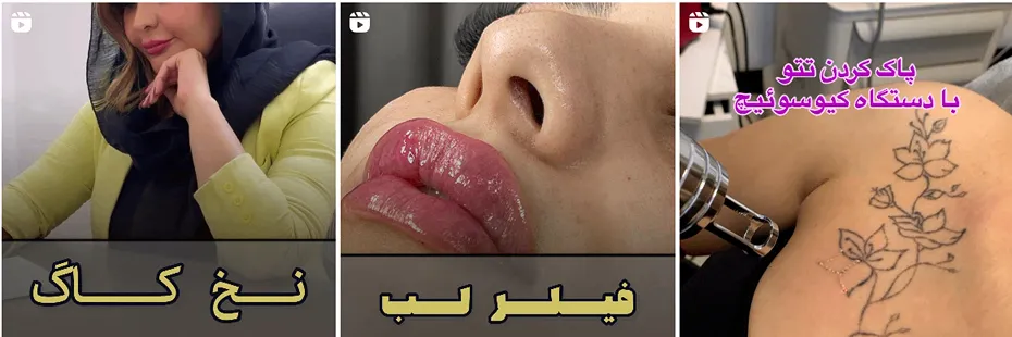 کلینیک آنجل یکی از بهترین کلینیک زیبایی مشهد است