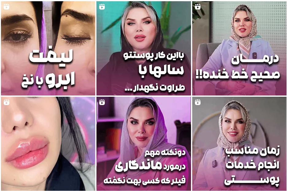 دکتر ارجمند از بهترین دکتر تزریق ژل لب روسی در مشهد است