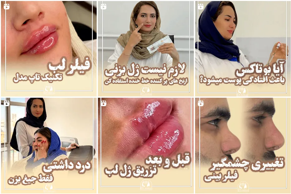 کانتورینگ صورت مشهد توسط دکتر اشکان قابل انجام است