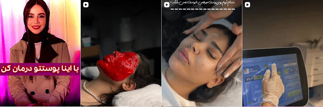 نمونه کار یکی از بهترین کلینیک لیزر در مشهد را مشاهده میفرمایید.