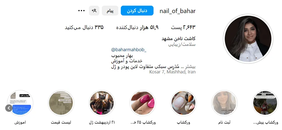 کاشت ناخن در مشهد توسط بهترین متخصصین کاملا قابل انجام است