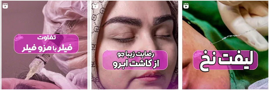 یکی از بهترین کلینیک لیفت صورت در مشهد بدون شک کلینیک بهاران است