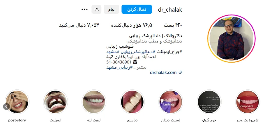 دکتر چالاک ا بهترین دکتر کامپوزیت دندان در مشهد است