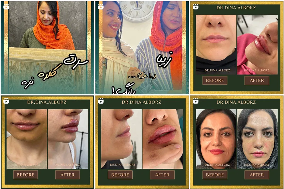 کلینیک دکتر البرز از بهترین مرکز کربوکسی تراپی در مشهد است