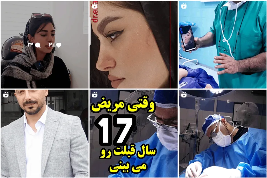 دکتر عرفانیان یکی از بترین جراح بینی مشهد است