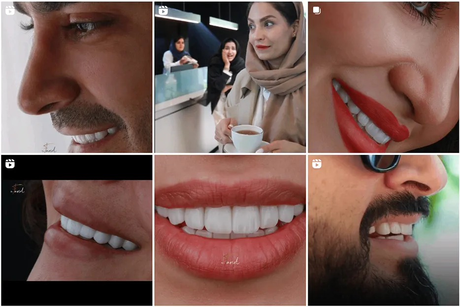 ایمپلنت دندان در مشهد توسط دکتر فاضلی کاملا قابل انجام است