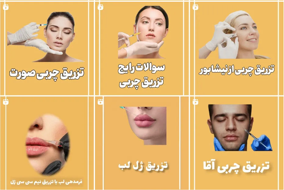 تزریق چربی در مشهد توط دکتر فرجی کاملا قابل انجام است