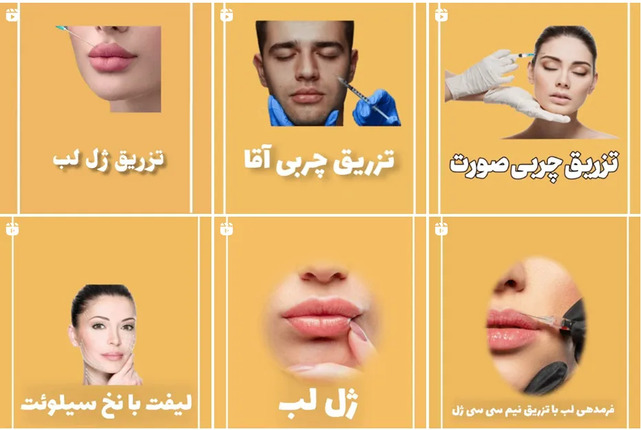 دکتر فرجی از بهترین تزریق ژل لب روسی در مشهد است