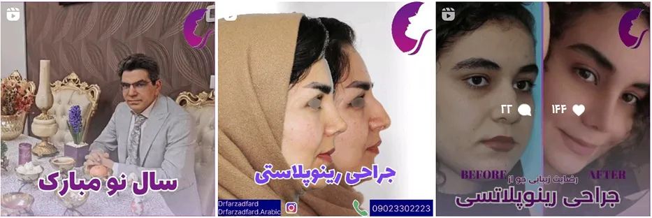 بلفاروپلاستی در مشهد توسط دکتر فرزادفر کاملا قابل انجام است