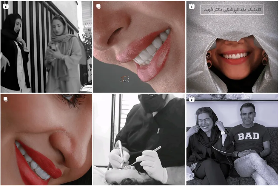 دکتر فاضلی از بهرتین متخصص لمینت در مشهد است