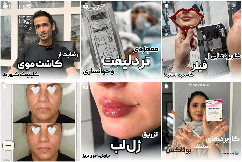 کانتورینگ صورت مشهد در کلینیک زیبای گهربد قابل انجام است