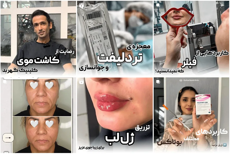 کلینیک گهربد یکی از بهترین مرکز اندولیفت در مشهد است