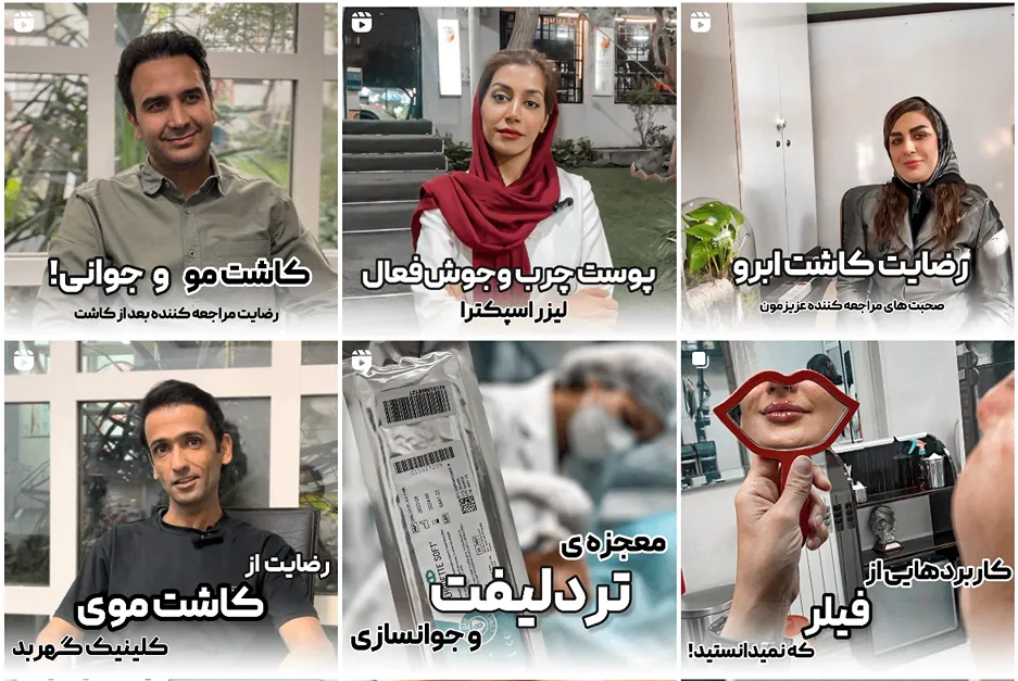نمونه کار یکی از بهترین کلینیک تزریق چربی در مشهد را مشاهده میفرمایید.