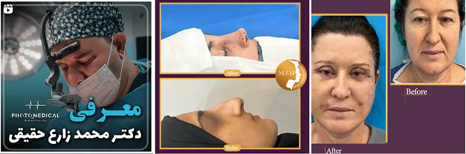 دکتر حقیقی یکی از بهترین متخصصین لیفت صورت در مشهد است