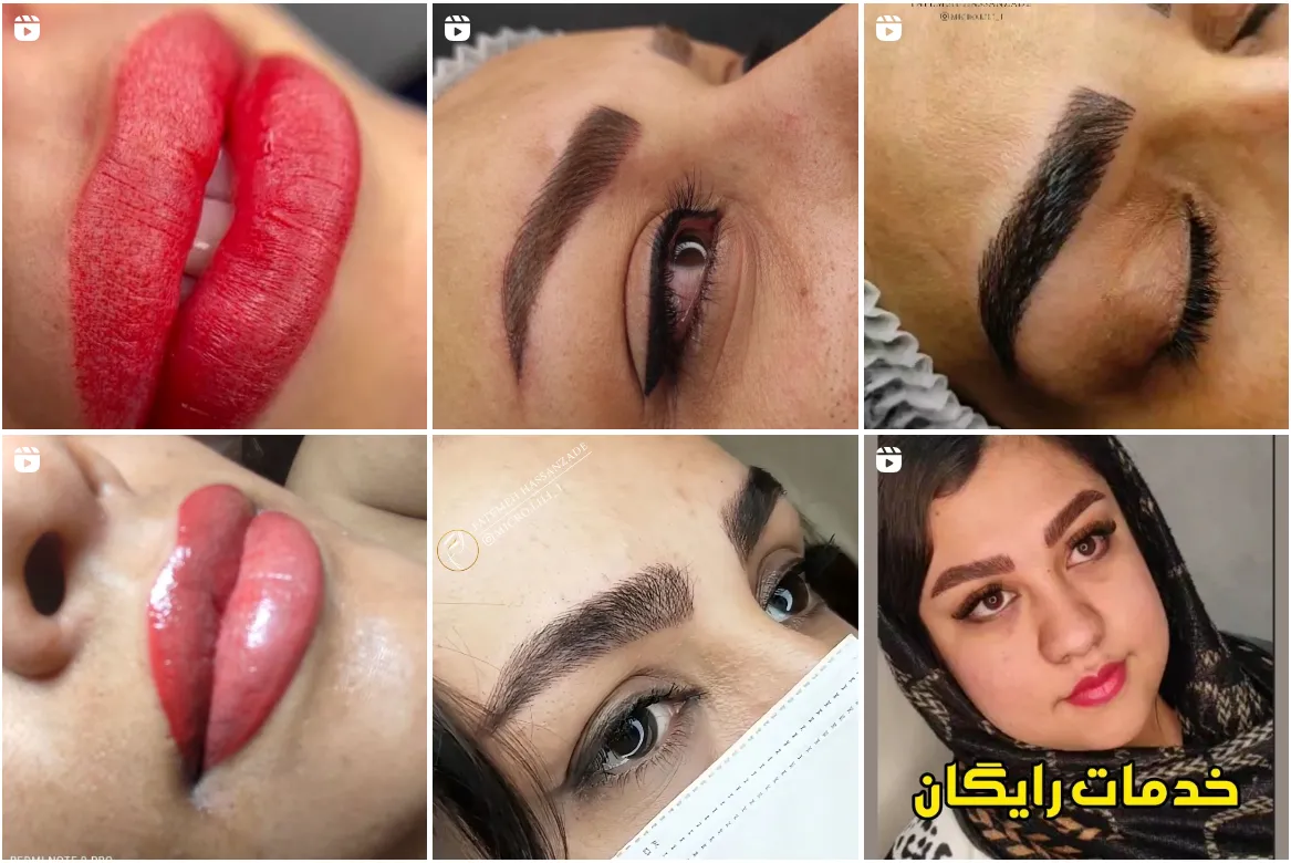 نمونه کار یکی از بهرتین شیدینگ لب مشهد را مشاههد میفرمایید.