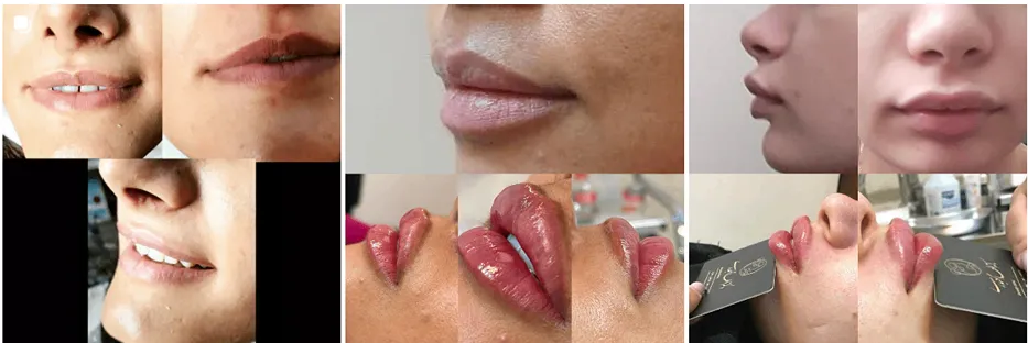 دکتر حیدری یکی از بهترین دکتر هایفوتراپی در مشهد است