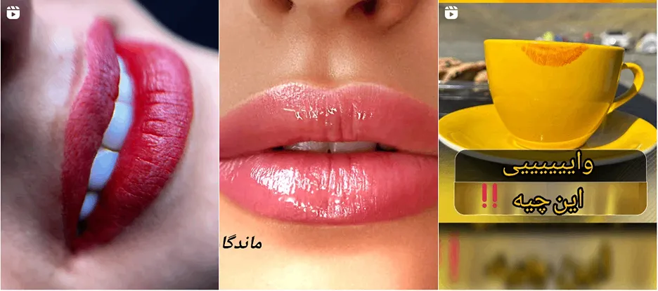 نمونه کار یکی از بهترین متخصصین شیدینگ لب در مشهد را میتوانید مشاهده بفرمایید.