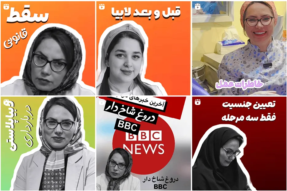 لابیاپلاستی مشهد توسط دکتر حسنی قابل انجام است