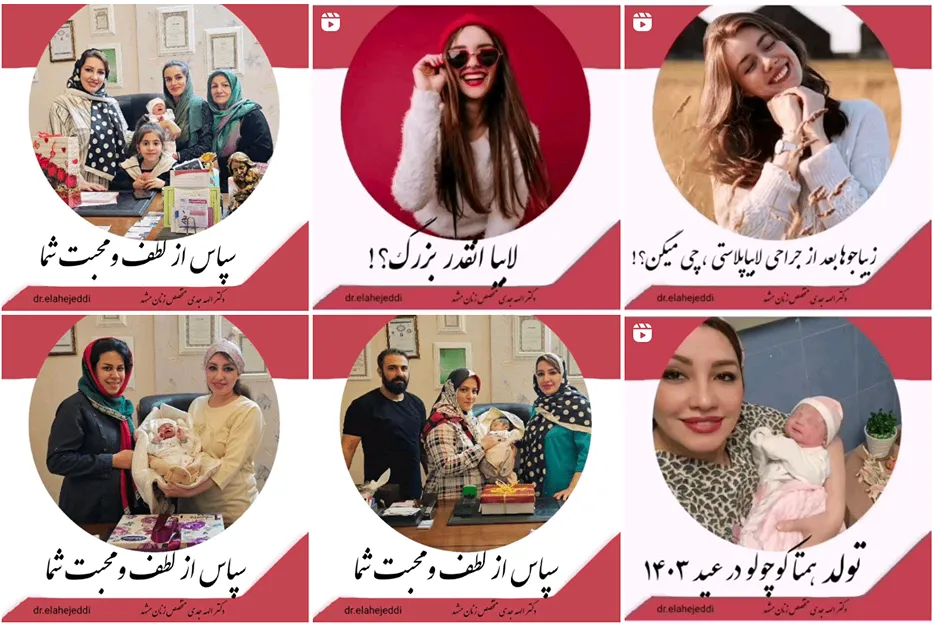 عمل زیبایی واژن در مشهد قابل انجام است