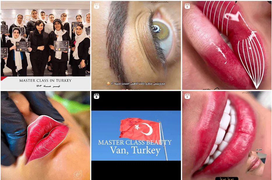 آرزو جاویدی از بهترین شیدینگ لب در مشهد است