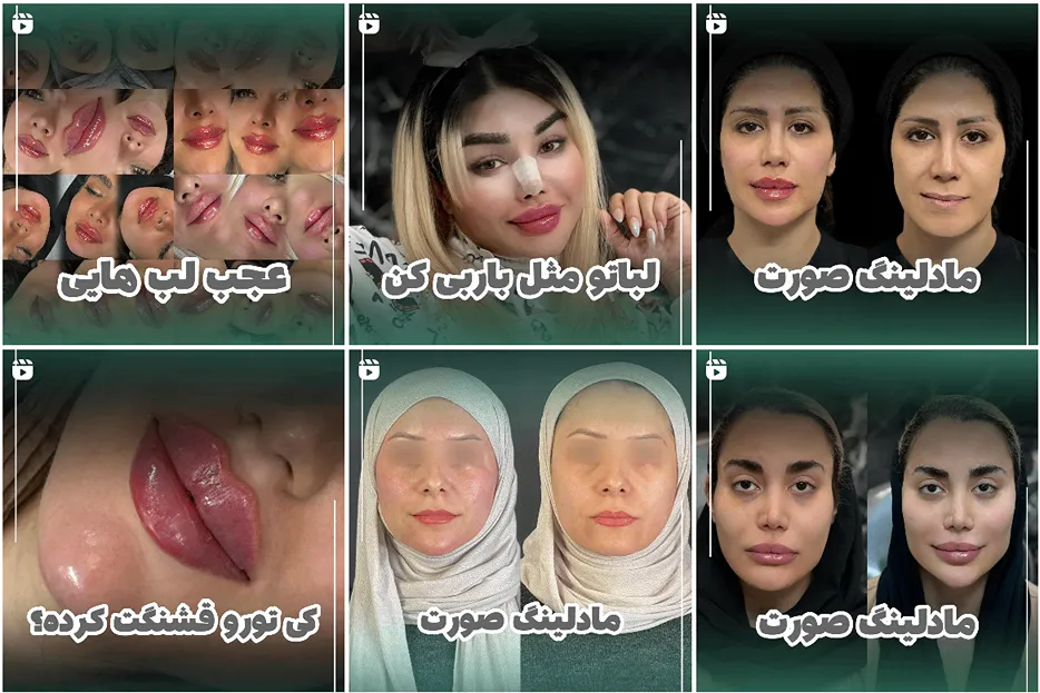 کانتورینگ صورت مشهد توسط دکتر کهنگی کاملا قابل اجرا است