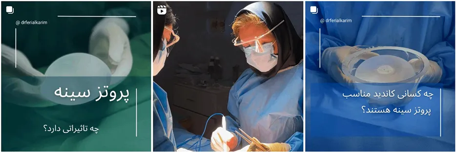 پروتز سینه در مشهد توسط دکتر فریال کریم قابل انجام است