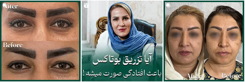 پی آر ی در مشهد توسط دکتر خانی کمالا قابل انجام است