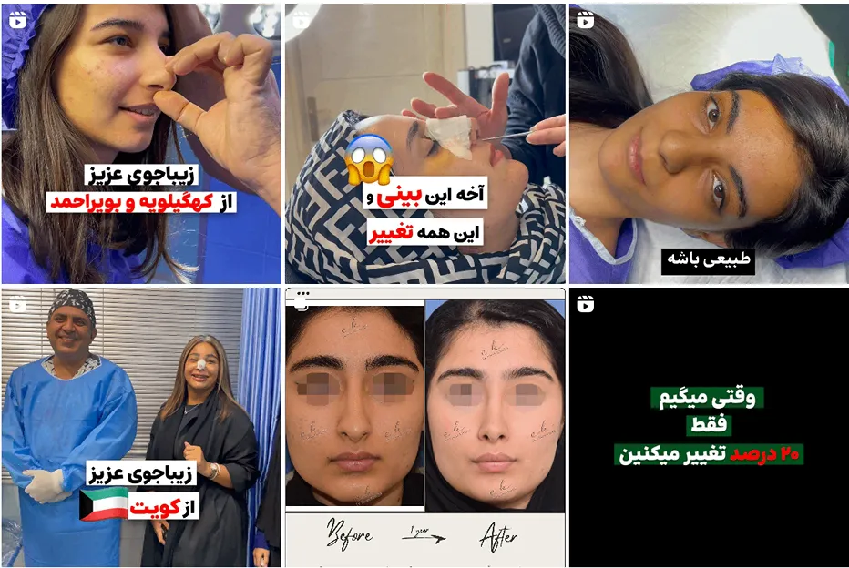 جراح بینی مشهد توسط دکتر خدیوی قابل انجام است