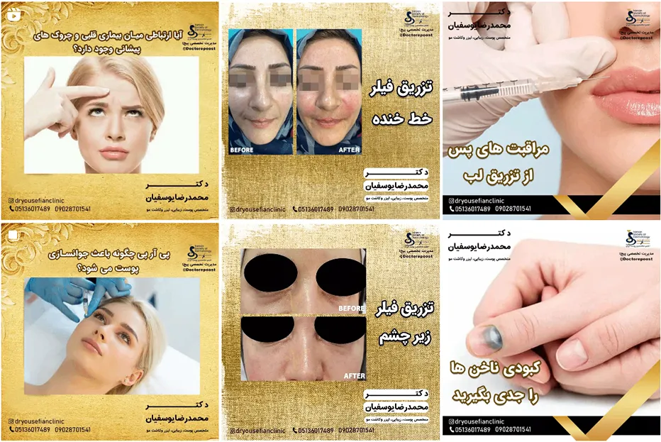 دکتر یوسفیان یکی از بهترین دکتر اندولیفت در مشهد است