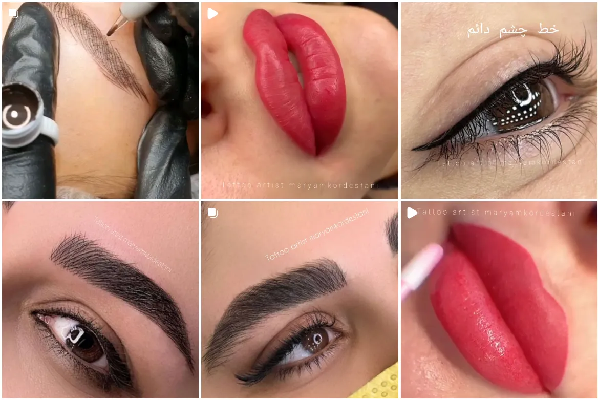 نمونه کار بهترین شیدینگ لب در مشهد را مشاههد میفرمایید.