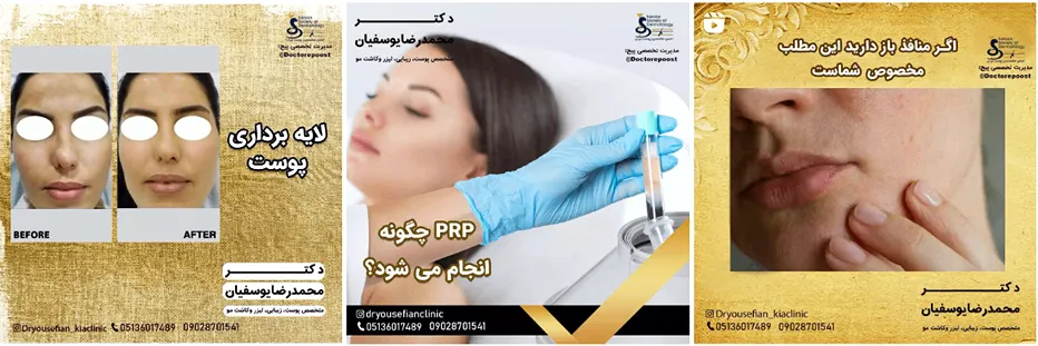 کلینیک کیا یکی از بهترین کلینیک لیفت صورت در مشهد است