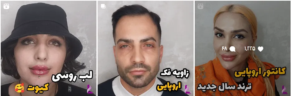 کانتورینگ صورت در مشهد در کلینیک لیدا قابل انجام است