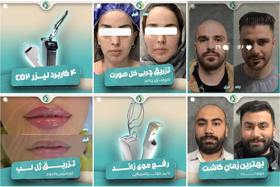 کلینیک زیبایی ماهان یکی از بهرتین مرکز لیزر در مشهد است