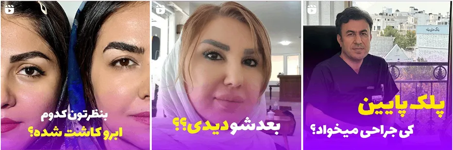 کلینیک مانا یکی از بهترین کلینیک هایفوتراپی در مشهد است