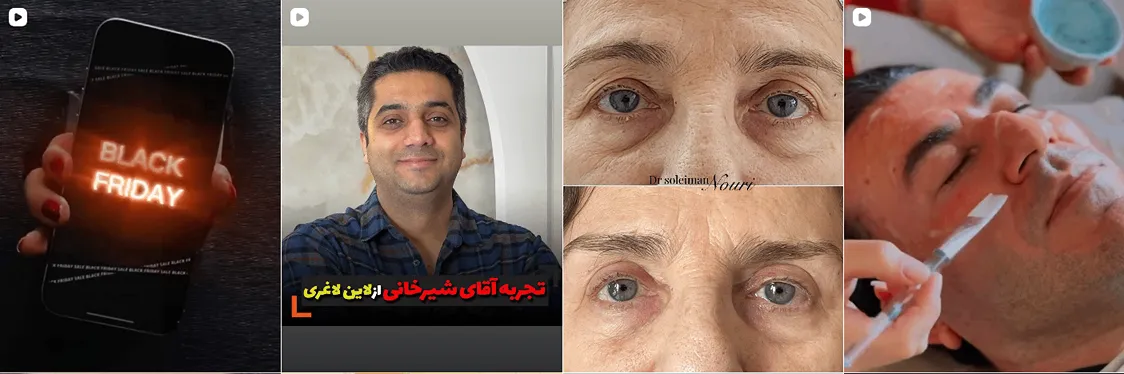 نمونه کار یکی از بهترین مرکز لیزر در مشهد را مشاهده میفرمایید.