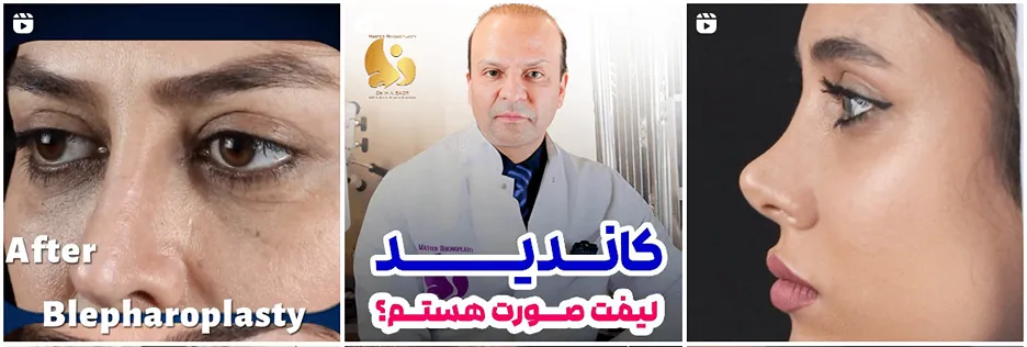 دکتر صدر از بهترین جراح بلفاروپلاستی در مشهد است