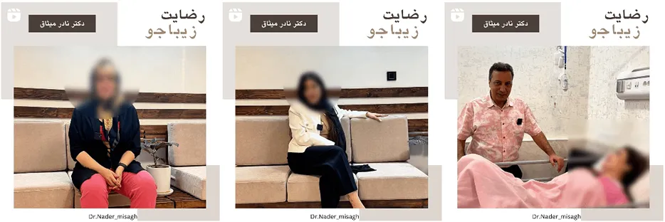 پروتز سینه در مشهد توسط دکتر میثاق کاملا قابل انجام است