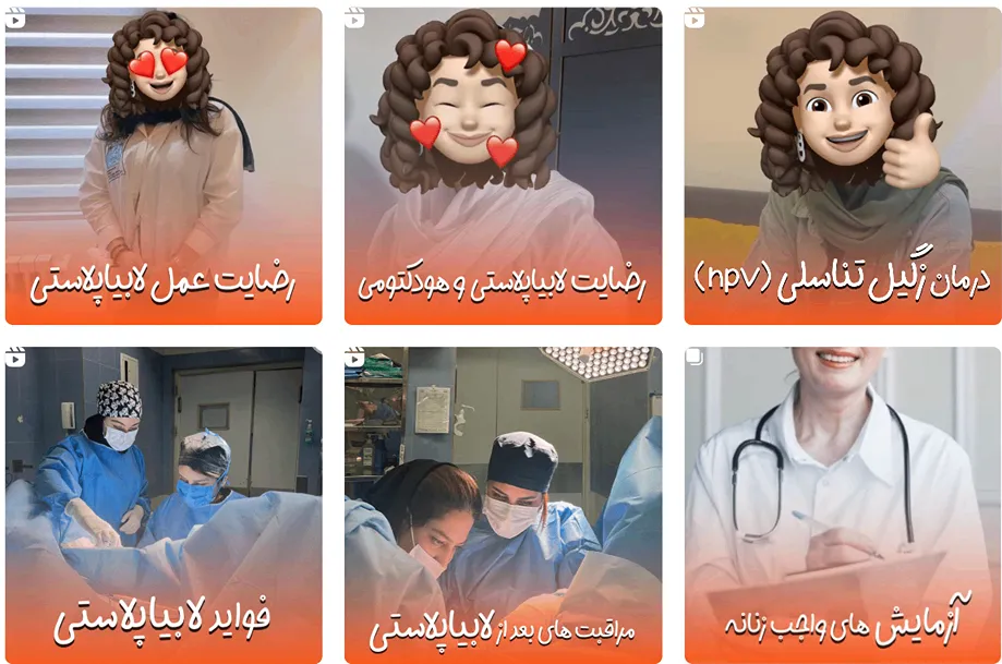 نمونه کار یکی از بهترین دکتر لابیاپلاستی در مشهد را میتوانید مشاهده بفرمایید.