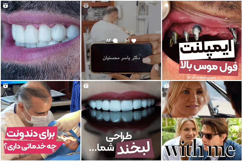 دکتر محسنیان از بهترین دکتر ایمپلنت در مشهد است